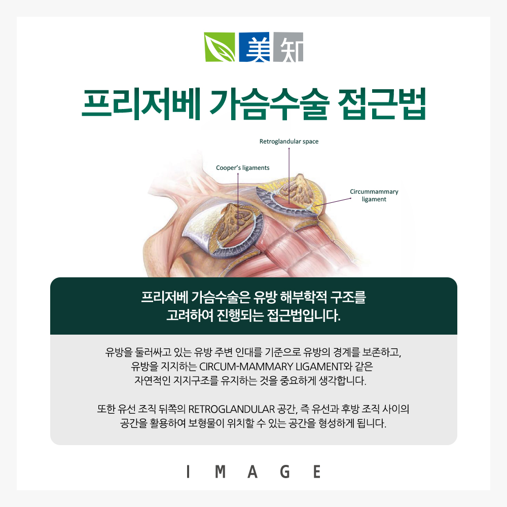 프리저베가슴성형