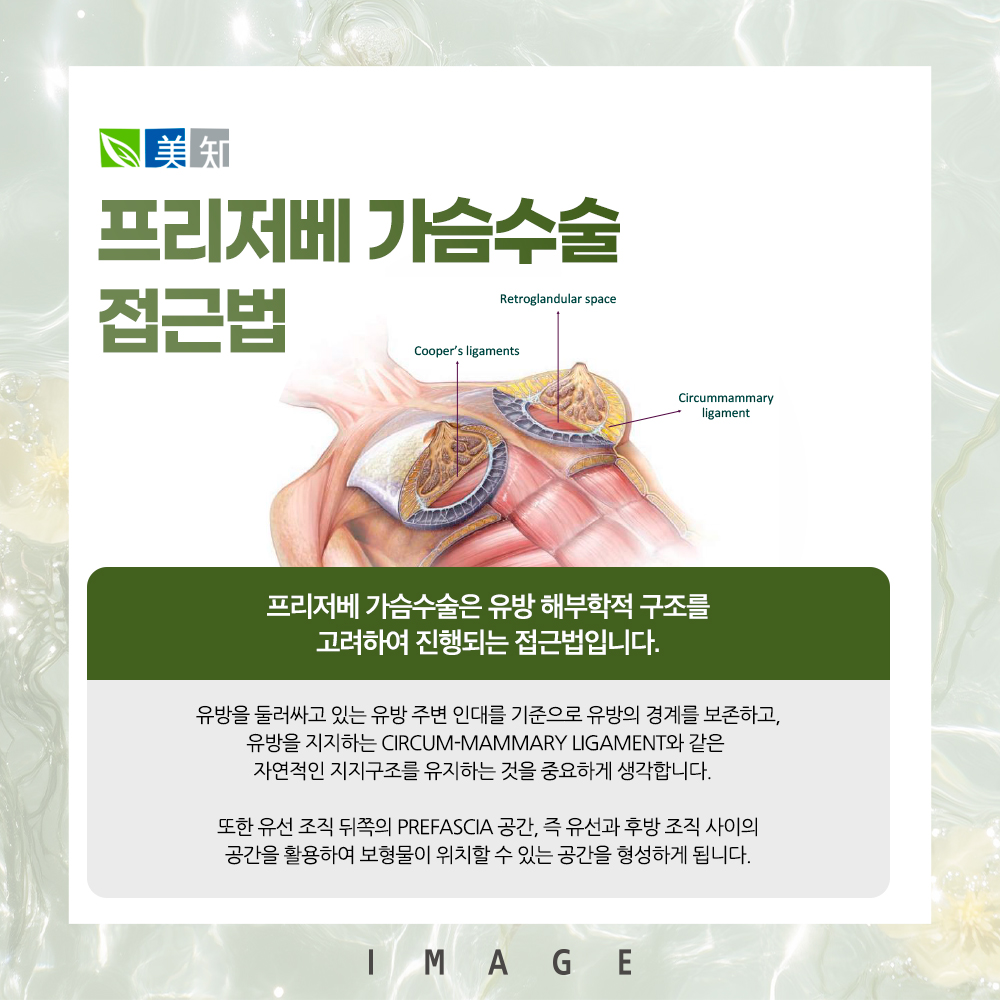 모티바프리저베 가슴수술 접근법