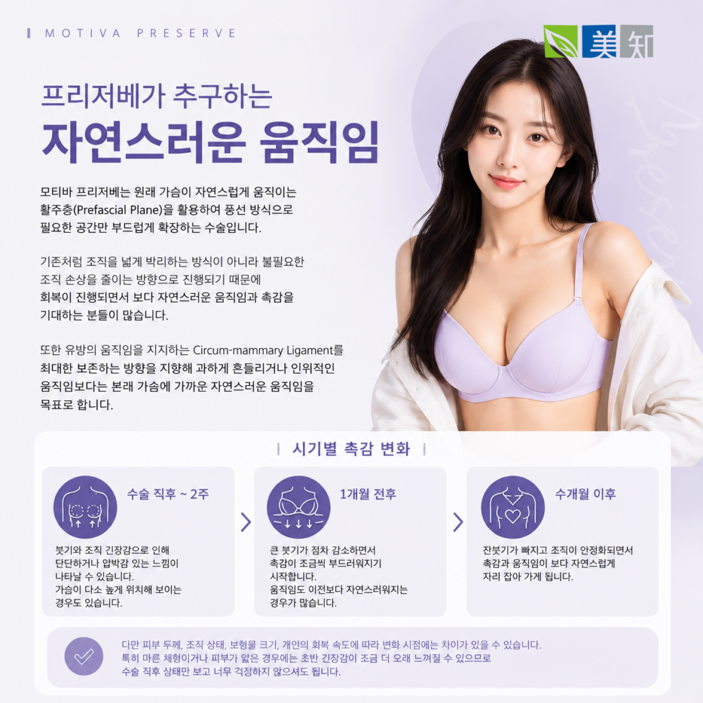 모티바 프리저베 움직임